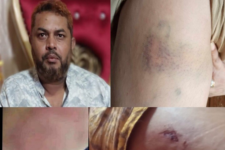 খুলনায় আ'লীগ নেতার ভাই আটক স্ত্রীকে নির্যাতন ও হত্যার অভিযোগে